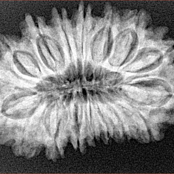 17 Mukhi Rudraksha 30.2mm 4.91gm - Xray