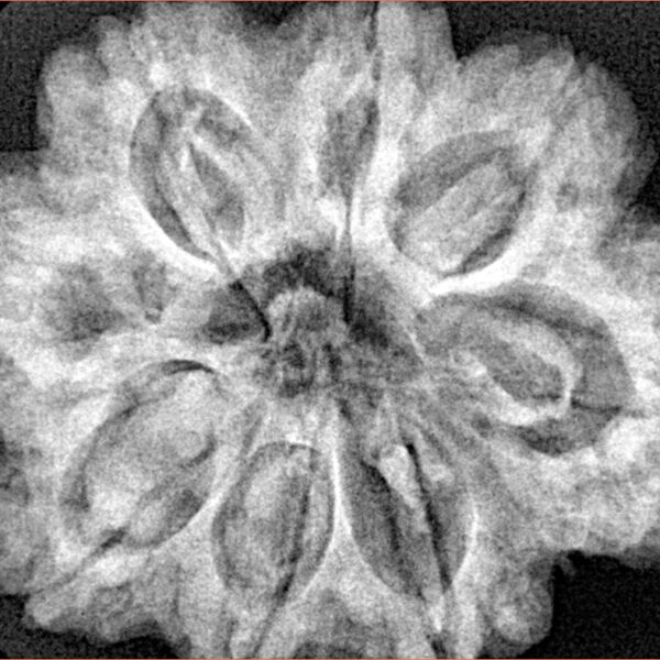8 Mukhi Rudraksha 29.7mm 7.77gm - Xray