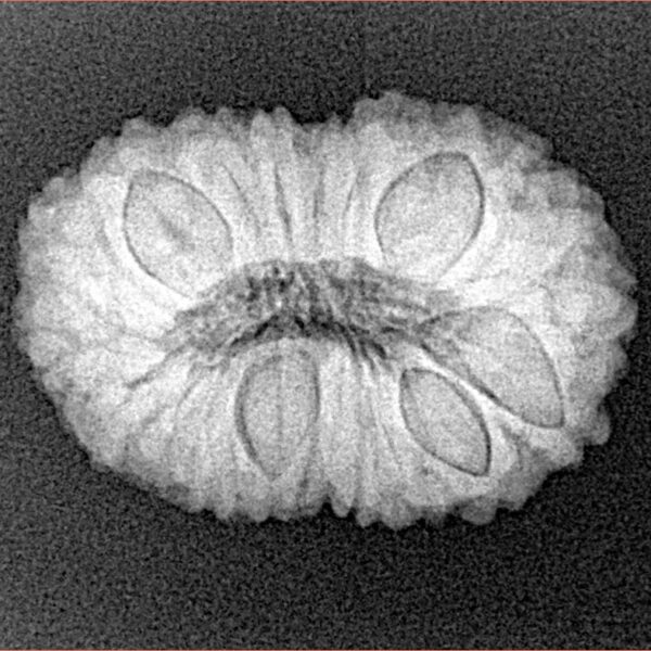 19 Mukhi Rudraksha 24.1mm 3.32gm - Xray