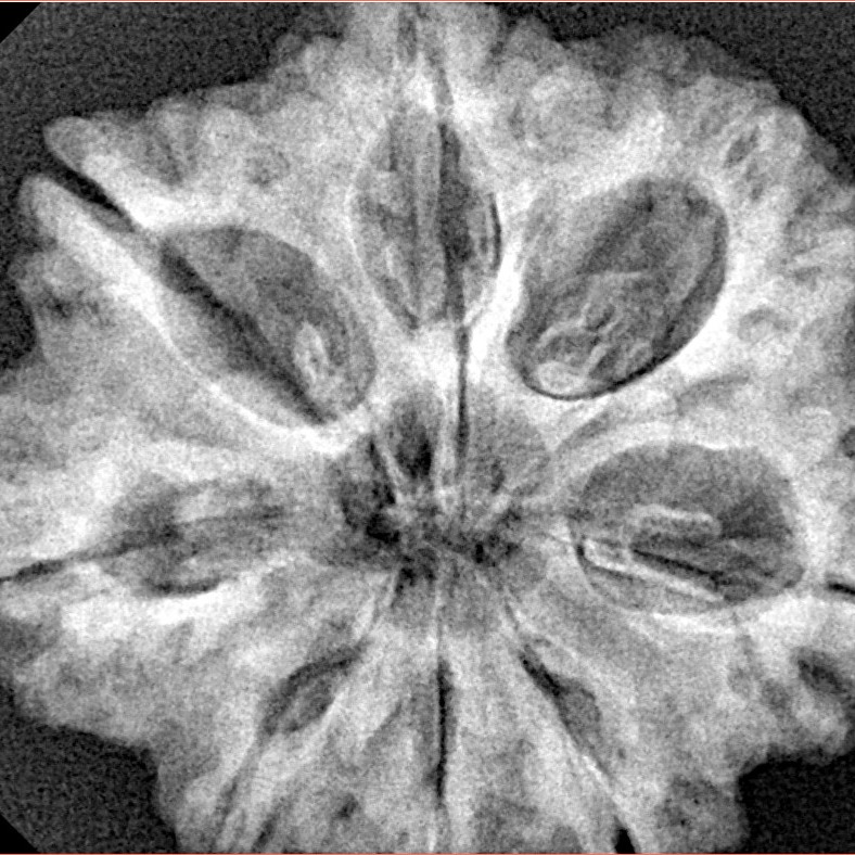 8 Mukhi Rudraksha 29.6mm 6.9gm - Xray