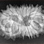 16 Mukhi Rudraksha 24.7mm 2.66gm - Xray