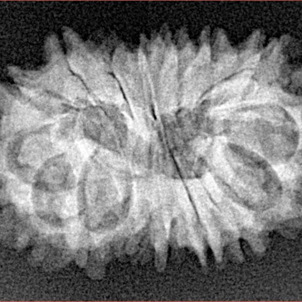 16 Mukhi Rudraksha 24.7mm 2.66gm - Xray