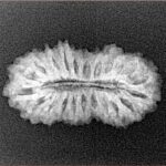 22 Mukhi Rudraksha 24.5mm 2.22gm - Xray