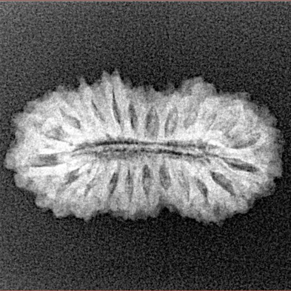 22 Mukhi Rudraksha 24.5mm 2.22gm - Xray