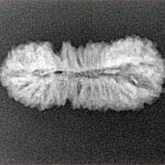 26 Mukhi Rudraksha 26.3mm 1.85gm - Xray