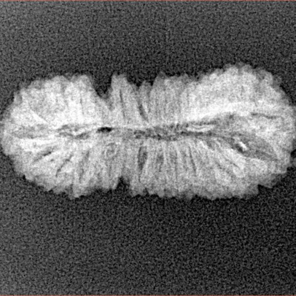 26 Mukhi Rudraksha 26.3mm 1.85gm - Xray