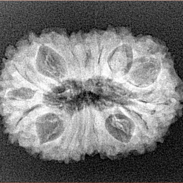 16 Mukhi Rudraksha 26.6mm 3.62gm - Xray
