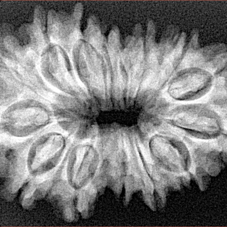 15 Mukhi Rudraksha 32.1mm 5.17gm - Xray
