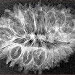 17 Mukhi Rudraksha 33mm 4gm - Xray