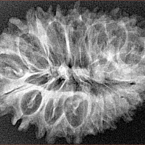 17 Mukhi Rudraksha 33mm 4gm - Xray