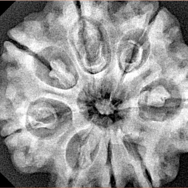 8 Mukhi Rudraksha 29.4mm 7.09gm - Xray