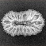 20 Mukhi Rudraksha 24.6mm 2.5gm - Xray
