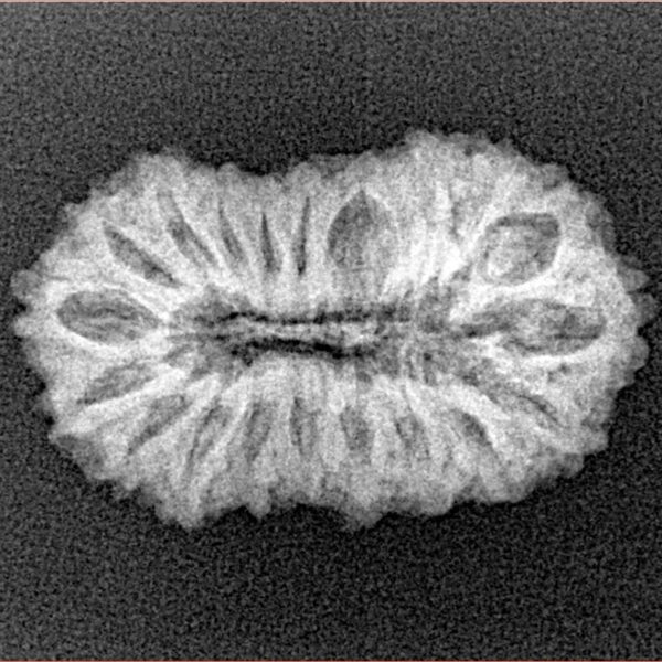 20 Mukhi Rudraksha 24.6mm 2.5gm - Xray