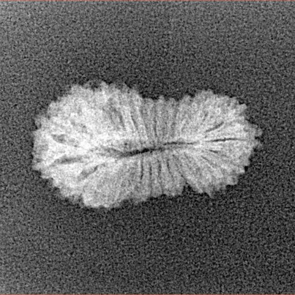 25 Mukhi Rudraksha 20mm 0.88gm - Xray