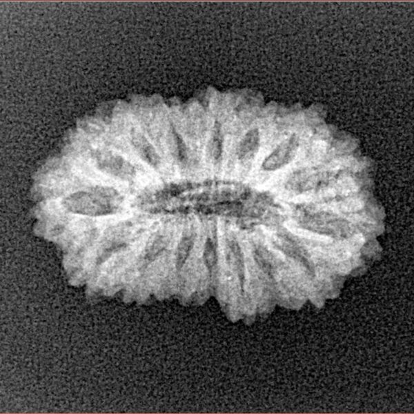 16 Mukhi Rudraksha 22.2mm 2gm - Xray