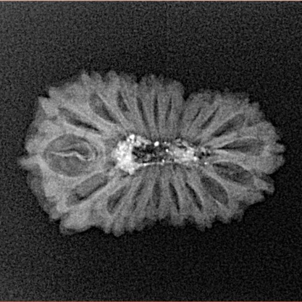 20 Mukhi Rudraksha 22.4mm 1.46gm - Xray