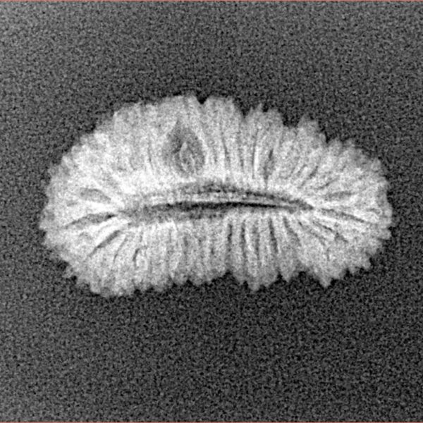 31 Mukhi Rudraksha 21.6mm 1.28gm - Xray