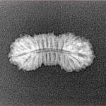 26 Mukhi Rudraksha 21.3mm 1gm - Xray