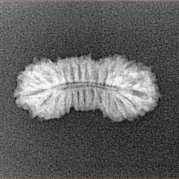 26 Mukhi Rudraksha 21.3mm 1gm - Xray