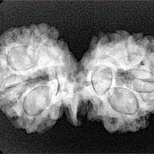 8 Mukhi G.S & Ganesh 32.1mm 4.67gm - Xray