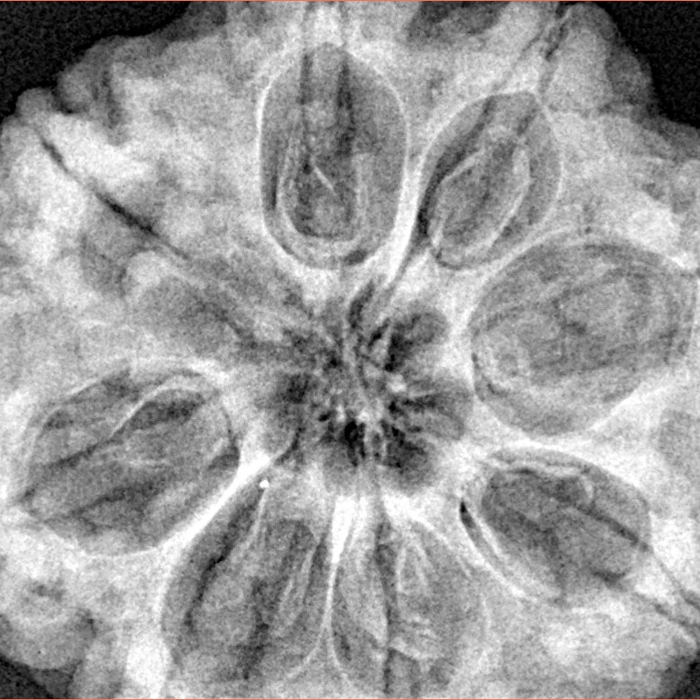 8 Mukhi Rudraksha 32.3mm 9.51gm - Xray