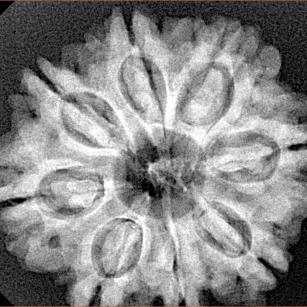 8 Mukhi Rudraksha 27.7mm 5.49gm - Xray
