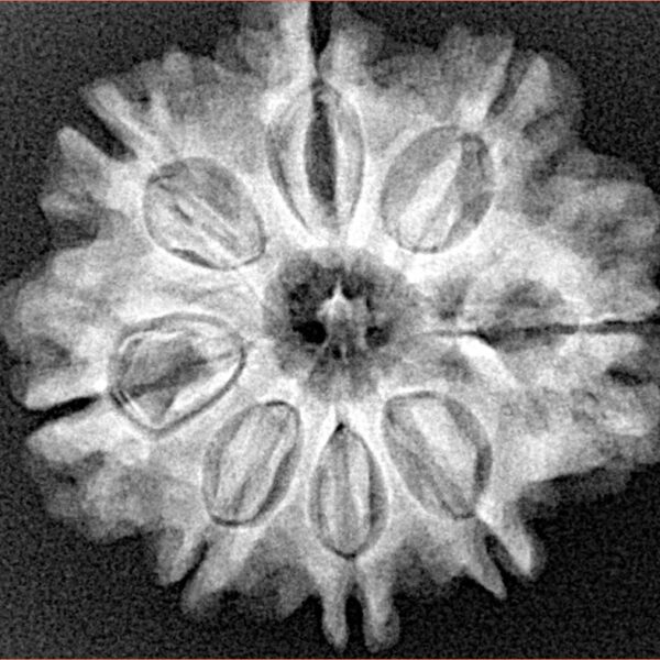 8 Mukhi Rudraksha 25.8mm 4.79gm - Xray