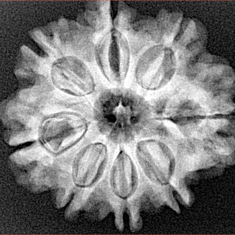 8 Mukhi Rudraksha 25.8mm 4.79gm - Xray
