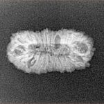 22 Mukhi Rudraksha 21.9mm 1.42gm - Xray