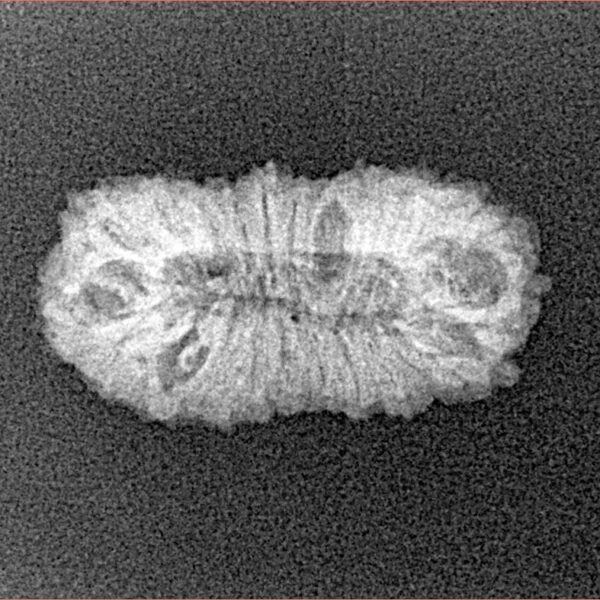 22 Mukhi Rudraksha 21.9mm 1.42gm - Xray