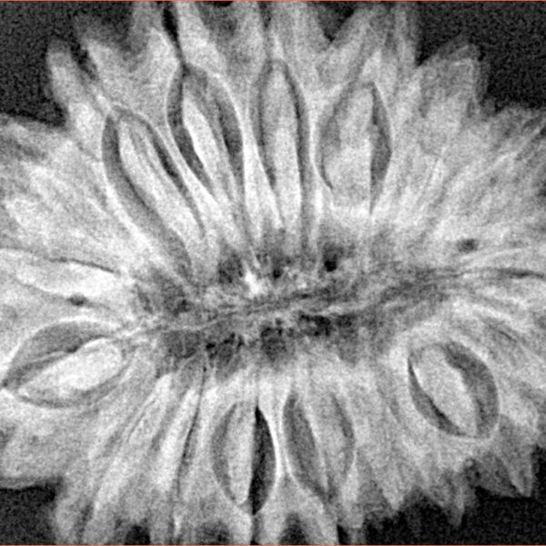 18 Mukhi Rudraksha 32.4mm 6.87gm - Xray
