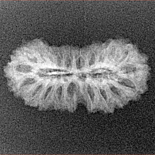 21 Mukhi Rudraksha 24mm 1.22gm - Xray