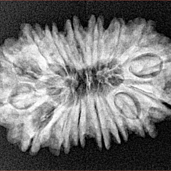 16 Mukhi Rudraksha 28mm 3.72gm - Xray