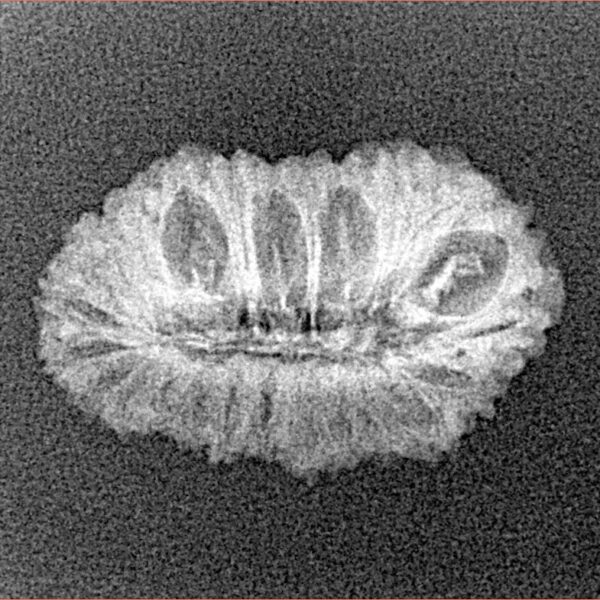 27 Mukhi Rudraksha 22.3mm 1.27gm - Xray