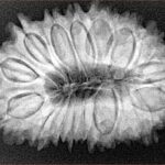 17 Mukhi Rudraksha 32.4mm 5.94gm - Xray