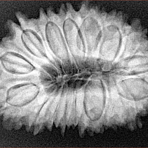 17 Mukhi Rudraksha 32.4mm 5.94gm - Xray