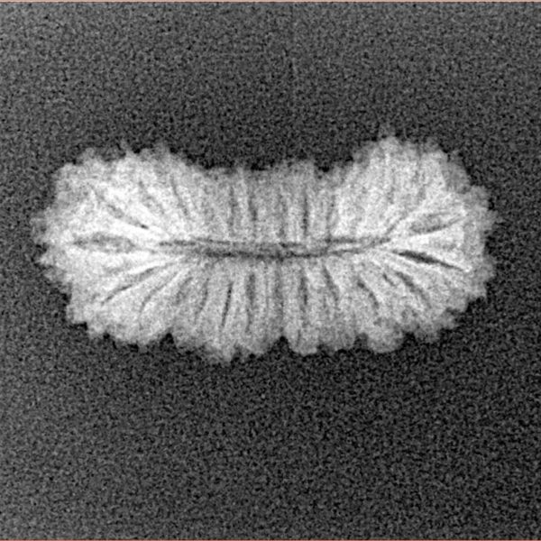 26 Mukhi Rudraksha 22.2mm 1.25gm - Xray