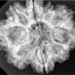 9 Mukhi Rudraksha 28.9mm 5.38gm - Xray
