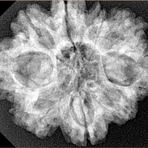9 Mukhi Rudraksha 28.9mm 5.38gm - Xray