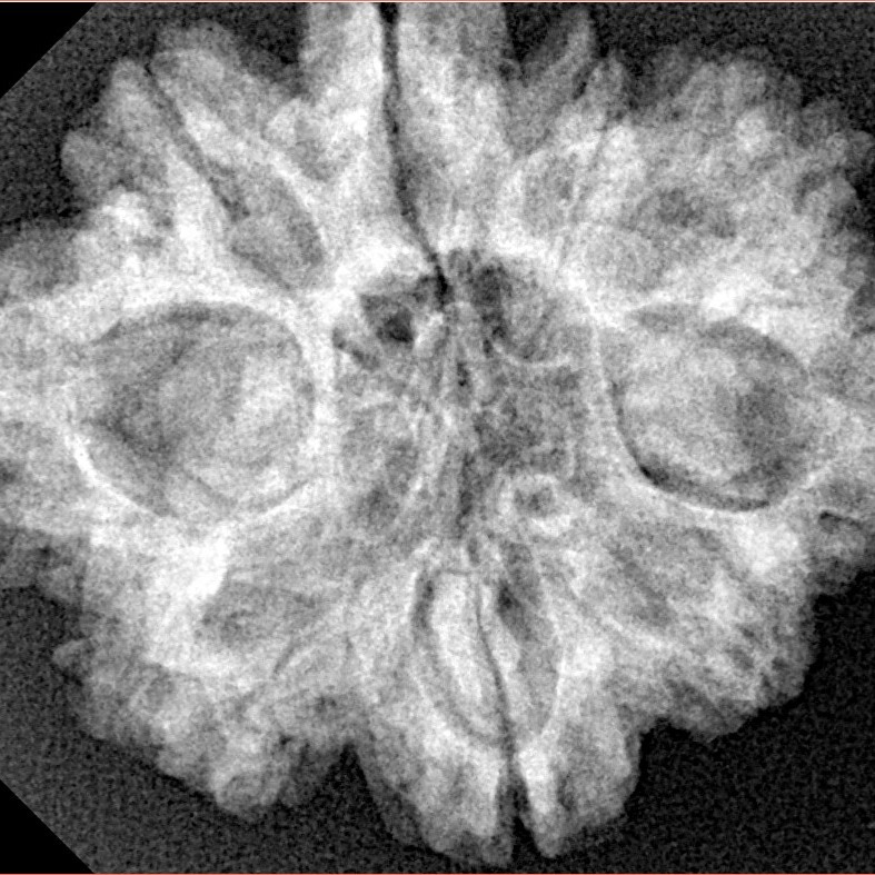 9 Mukhi Rudraksha 28.9mm 5.38gm - Xray