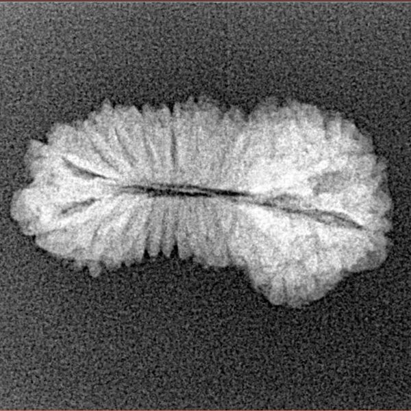 24 Mukhi Rudraksha 23.8mm 1.6gm - Xray