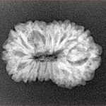 16 Mukhi Rudraksha 23.8mm 2.54gm - Xray