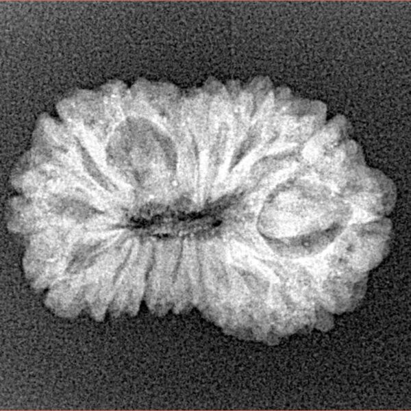 16 Mukhi Rudraksha 23.8mm 2.54gm - Xray