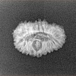 22 Mukhi Rudraksha 18.1mm 1.14gm - Xray