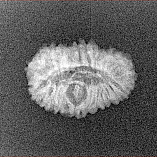 22 Mukhi Rudraksha 18.1mm 1.14gm - Xray