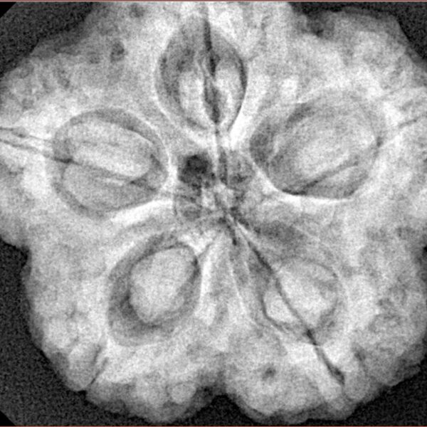 5 Mukhi Rudraksha 29.5mm 8.63gm - Xray