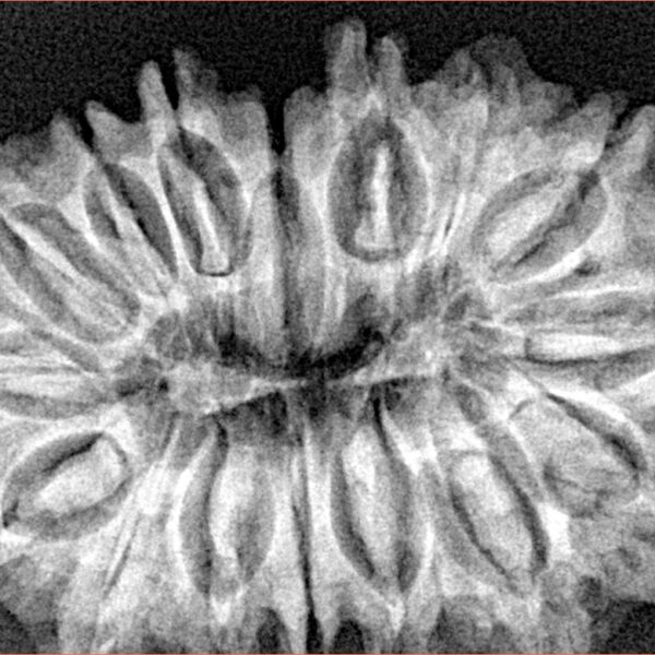 16 Mukhi Rudraksha 33.8mm 5.85gm - Xray