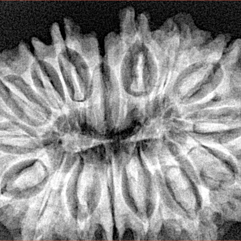 16 Mukhi Rudraksha 33.8mm 5.85gm - Xray