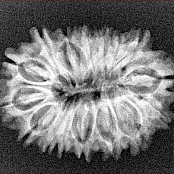16 Mukhi Rudraksha 27.1mm 3.46gm - Xray