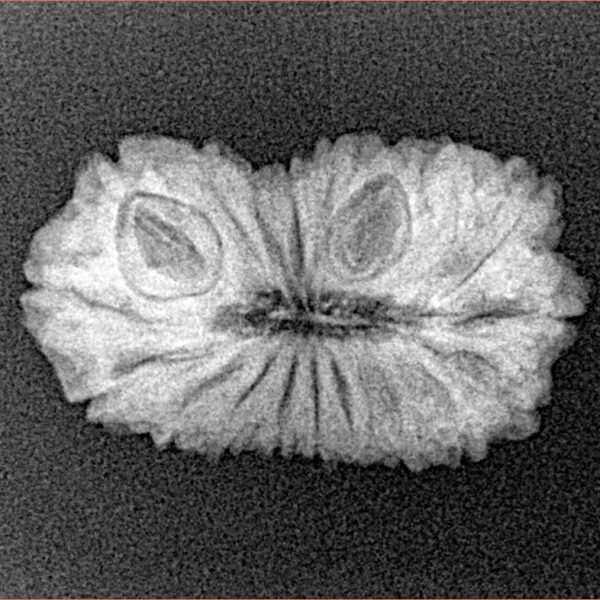 19 Mukhi Rudraksha 23.9mm 2.25gm - Xray